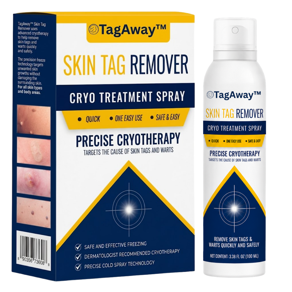 TagAway